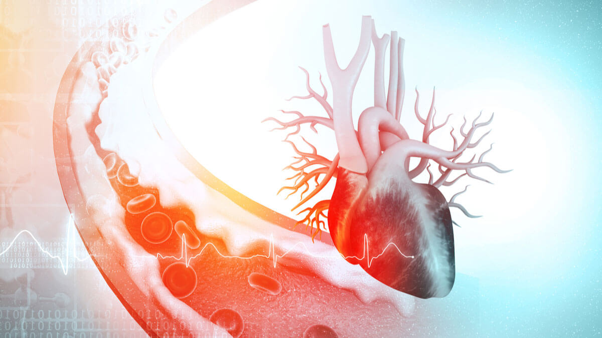 Logo der CME Fortbildung "Dyslipidämien: Statin- und 2-Komponenten-Cholesterinsenkung zur Prävention kardiovaskulärer Erkrankungen"