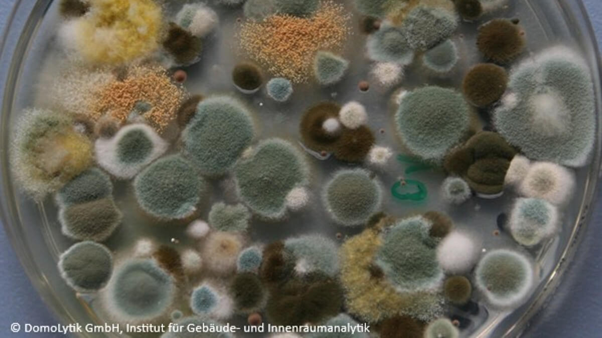 Logo der CME Fortbildung "Invasive Schimmelpilzinfektionen beim Patienten auf der Intensivstation"