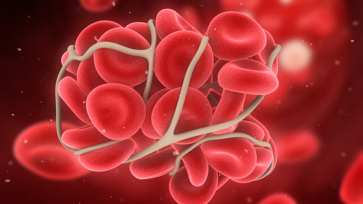 Logo der CME Fortbildung "Bridging bei Pausieren einer dauerhaften oralen Antikoagulation"