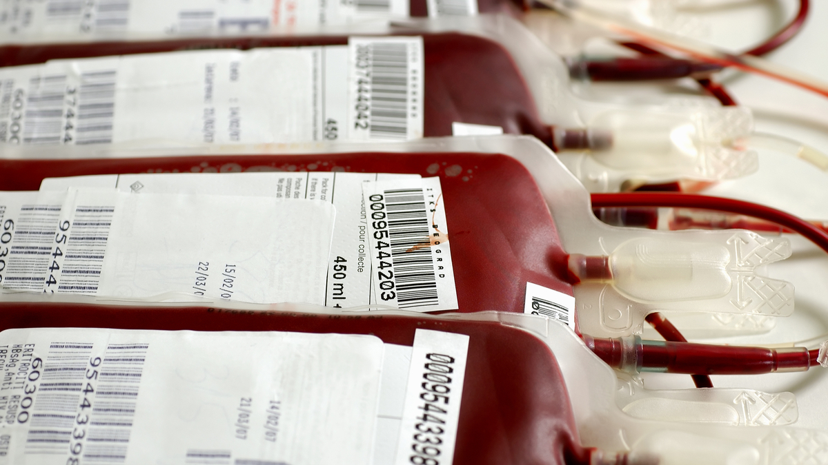 Logo der CME Fortbildung "Chronische transfusionsbedingte Eisenüberladung bei Patienten mit myelodysplastischen Syndromen"