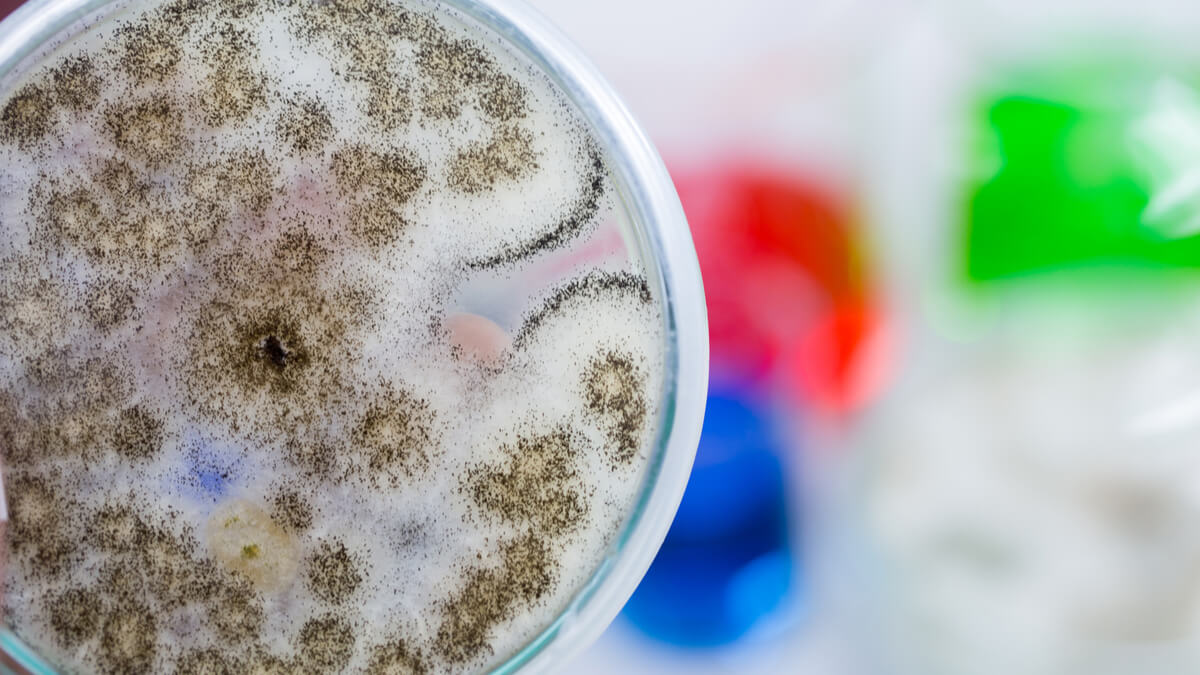 Logo der CME Fortbildung "Diagnostik invasiver Aspergillus- und Mucor-Infektionen"