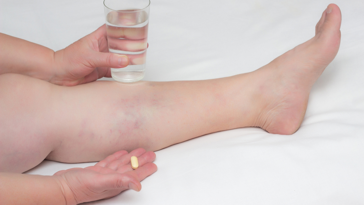 Logo der CME Fortbildung "Therapie tumorassoziierter venöser Thromboembolien - Neue Daten, neue Möglichkeiten?"