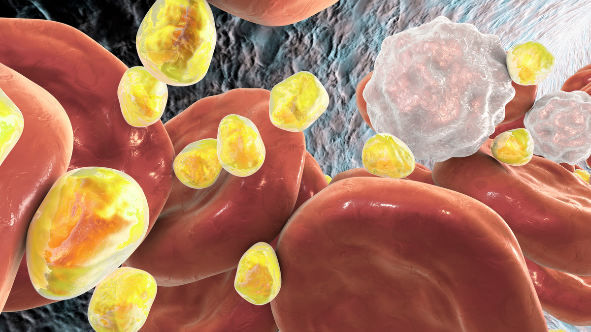Logo der CME Fortbildung "HIV-Infektion & ART - Auswirkungen auf den Lipidstoffwechsel"