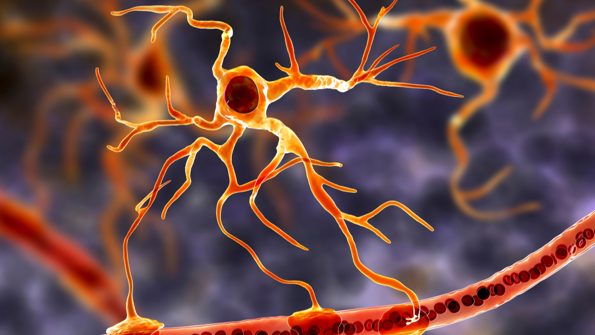 Logo der CME Fortbildung "Aktuelles zur Therapie der Neuromyelitis-optica-Spektrum-Erkrankungen (NMOSD)"