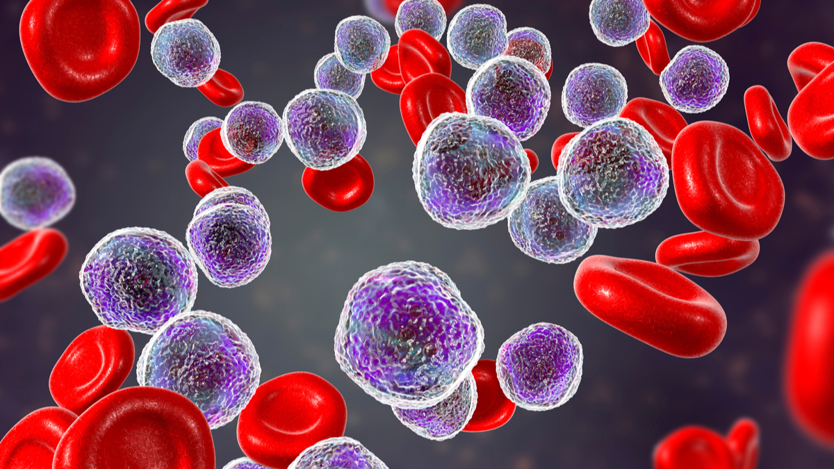 Logo der CME Fortbildung "Zielgerichtete Therapieoptionen bei chronischer lymphatischer Leukämie (CLL) in 2020"
