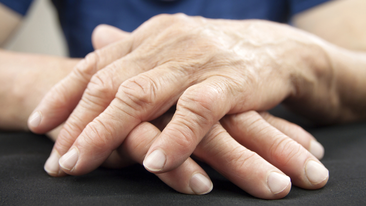 Logo der CME Fortbildung "JAK-Inhibitoren in der rheumatoiden Arthritis – ein genauer Blick"