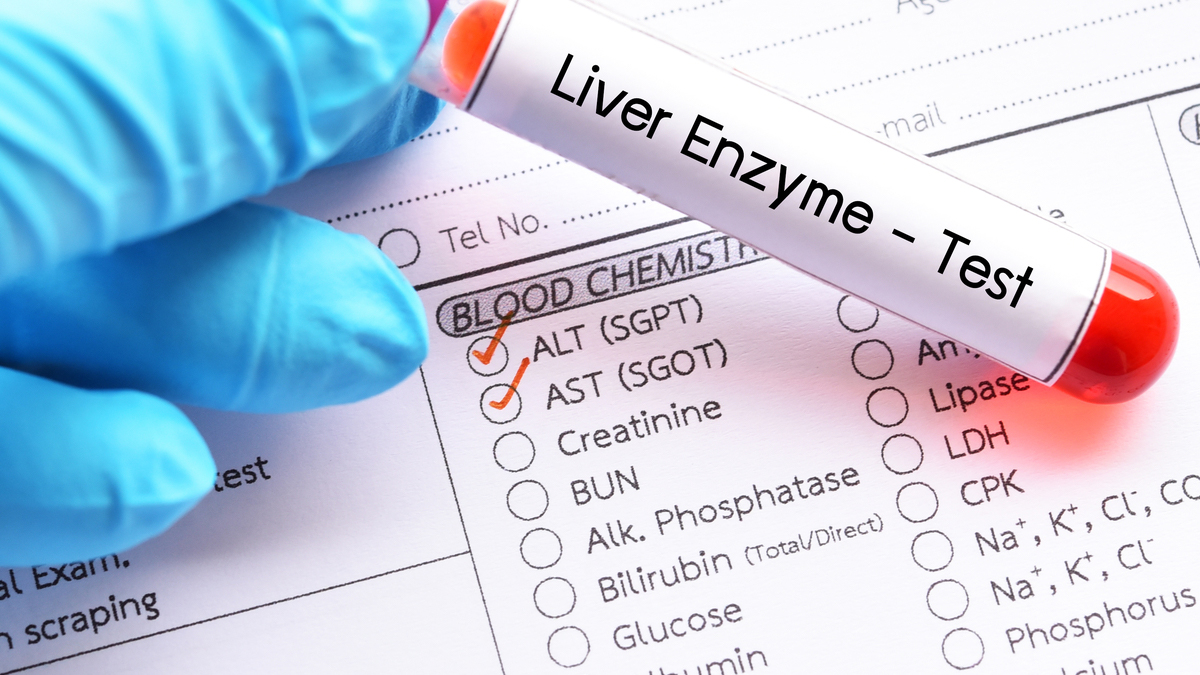Logo der CME Fortbildung "Hepatotoxizität - Was kann erhöhte Leberwerte auslösen?"