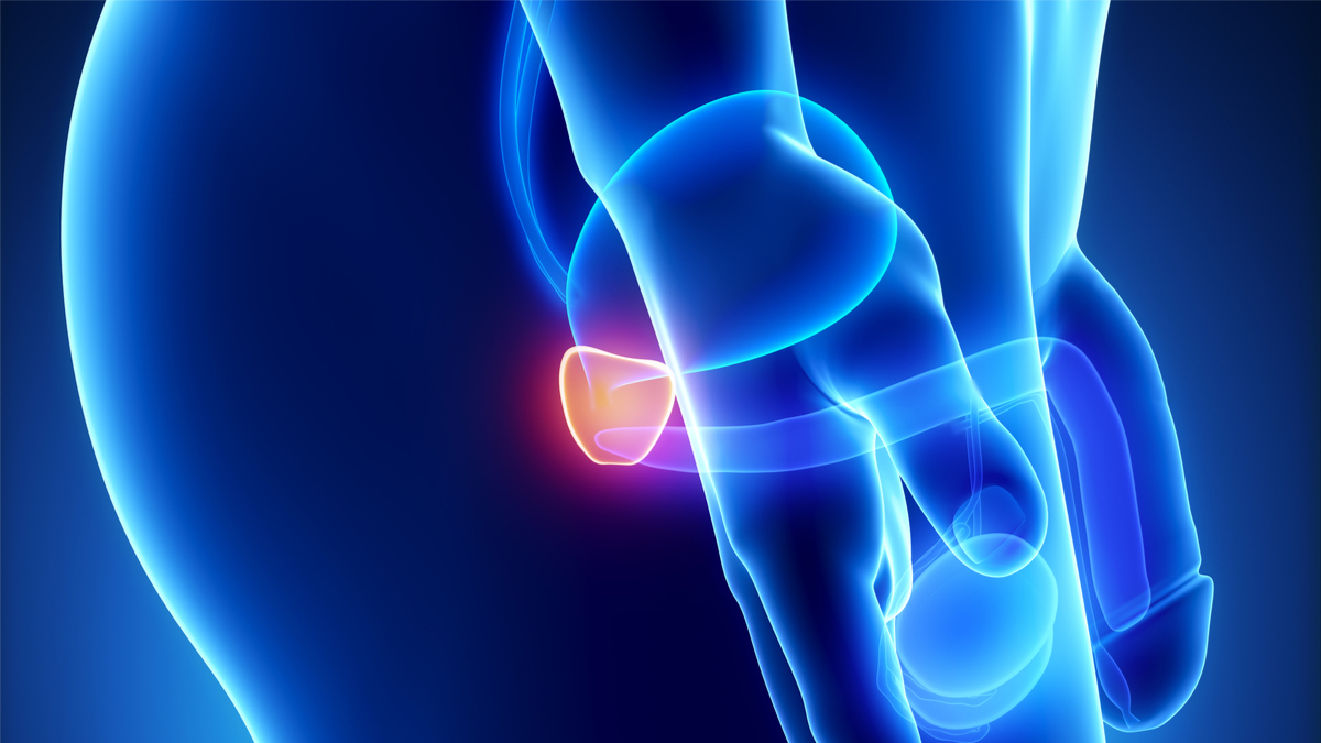 Logo der CME Fortbildung "Prostatitis"