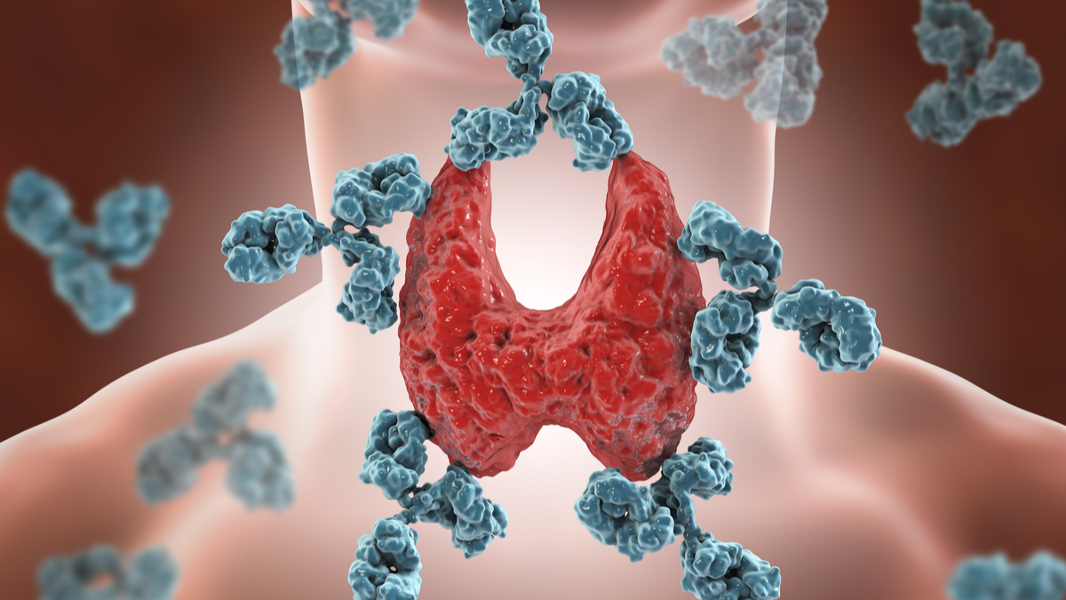 Logo der CME Fortbildung "Hashimoto & Co. Autoimmunthyreoiditis heute"