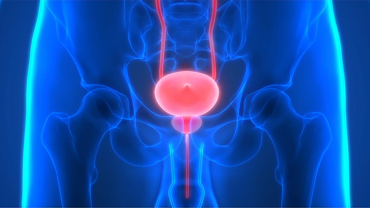 Logo der CME Fortbildung "Paradigmenwechsel Erstlinien Erhaltungstherapie beim metastasierten Urothelkarzinom "