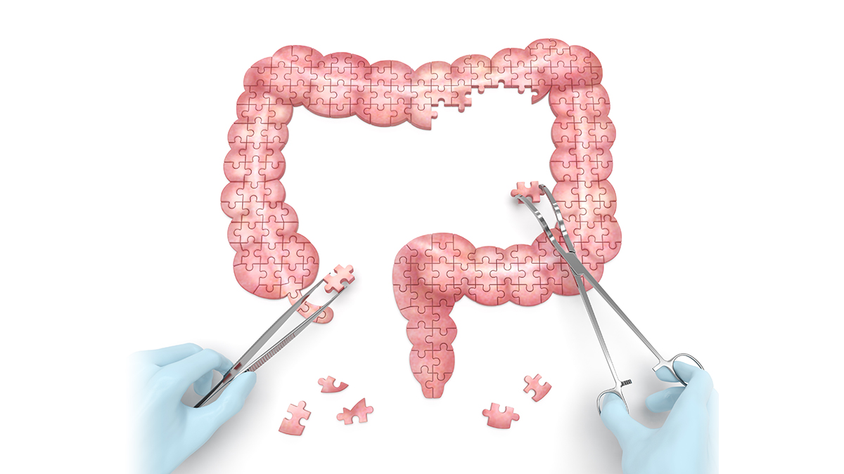 Logo der CME Fortbildung "Darmultraschall bei Colitis ulcerosa"