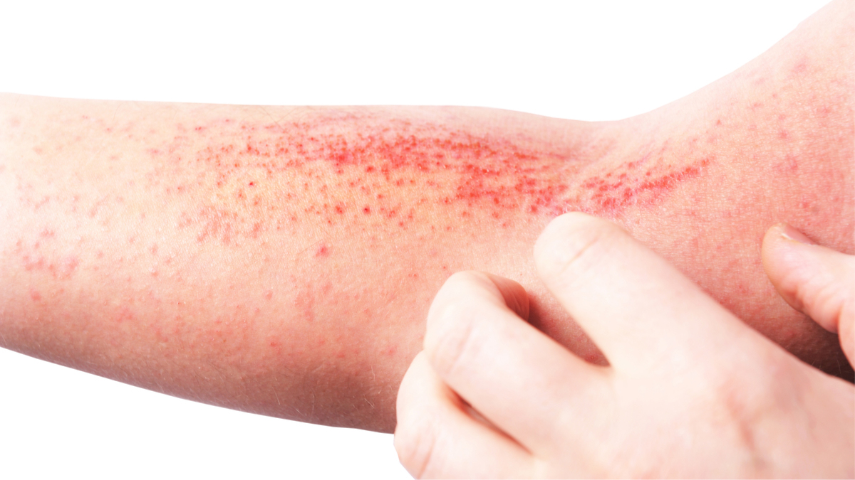 Logo der CME Fortbildung "Register in der Dermatologie - Focus: Atopische Dermatitis"