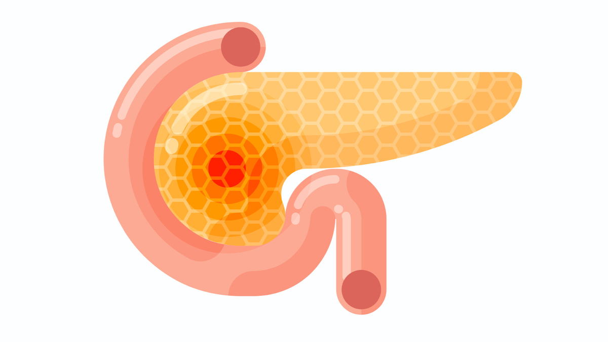 Logo der CME Fortbildung "Die prä- und die postoperative Versorgung bei exokriner Pankreasinsuffizienz"