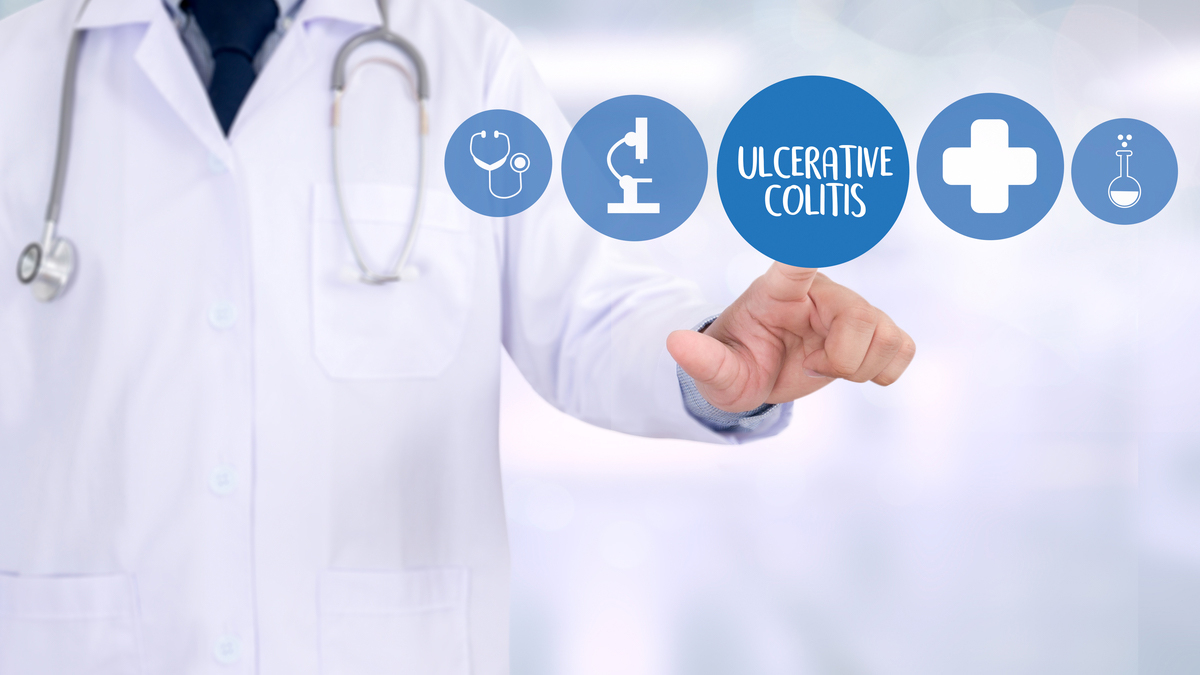 Teaserbild zum CME: Therapie der Colitis ulcerosa im Wandel - Falldiskussion