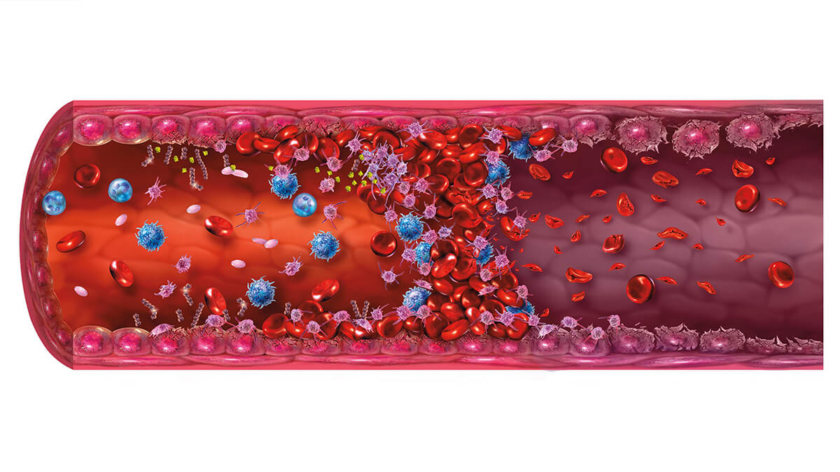 Logo der CME Fortbildung "Thrombotische Mikroangiopathien: Pathophysiologie, Differentialdiagnosen und Therapie"