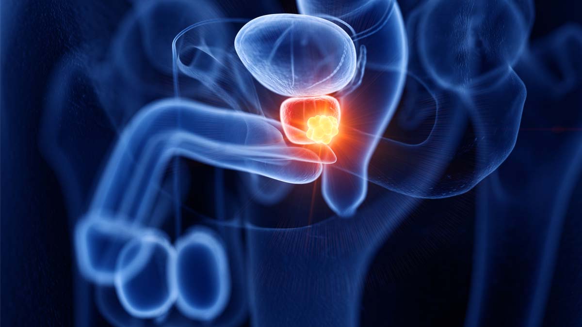 Logo der CME Fortbildung "Update in der Diagnostik und Therapie beim mCRPC – uro-onkologische und nuklearmedizinische Ansätze "