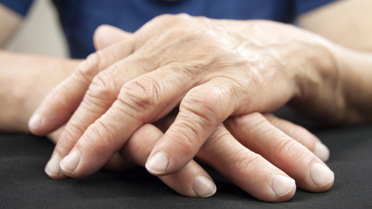 Logo der CME Fortbildung "JAK-Inhibitoren in der rheumatoiden Arthritis – ein genauer Blick"