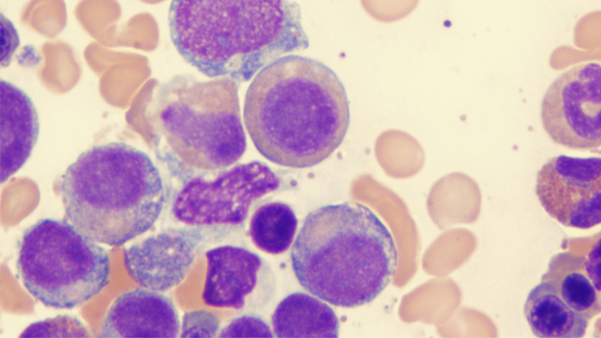 Logo der CME Fortbildung "Immuntherapeutische Ansätze bei MDS – Neue Perspektiven"