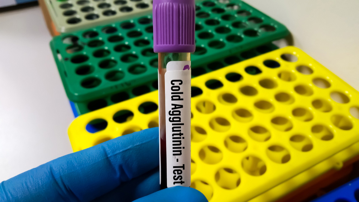 Logo der CME Fortbildung "Hämolytische Anämien: Diagnose und Differentialdiagnose der Kälteagglutinin-Krankheit"