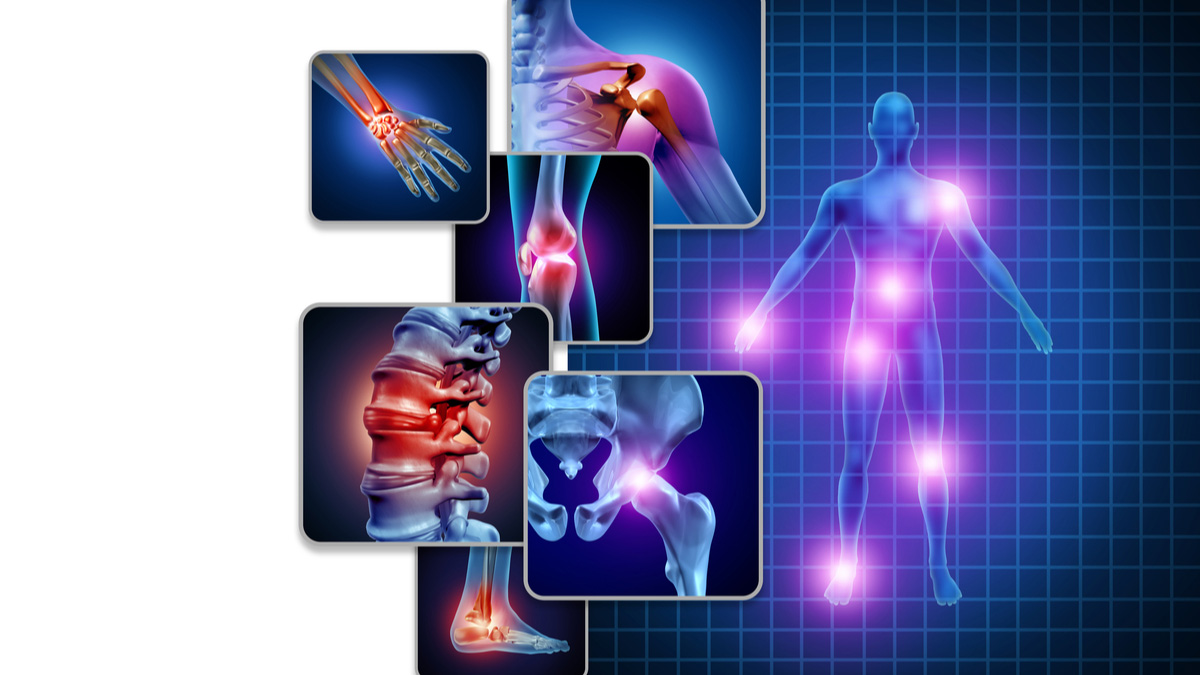 Logo der CME Fortbildung "Stellenwert der JAK-Inhibitoren in der Rheumatologie"