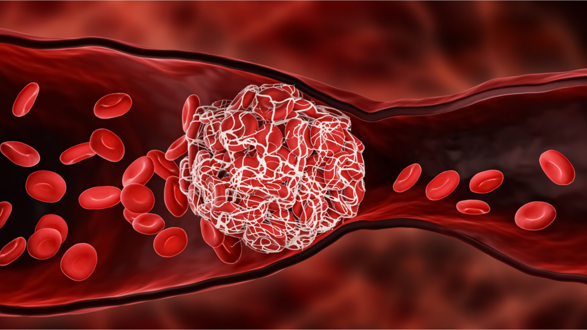 Logo der CME Fortbildung "Parenterale und orale Antikoagulation im Alltag"