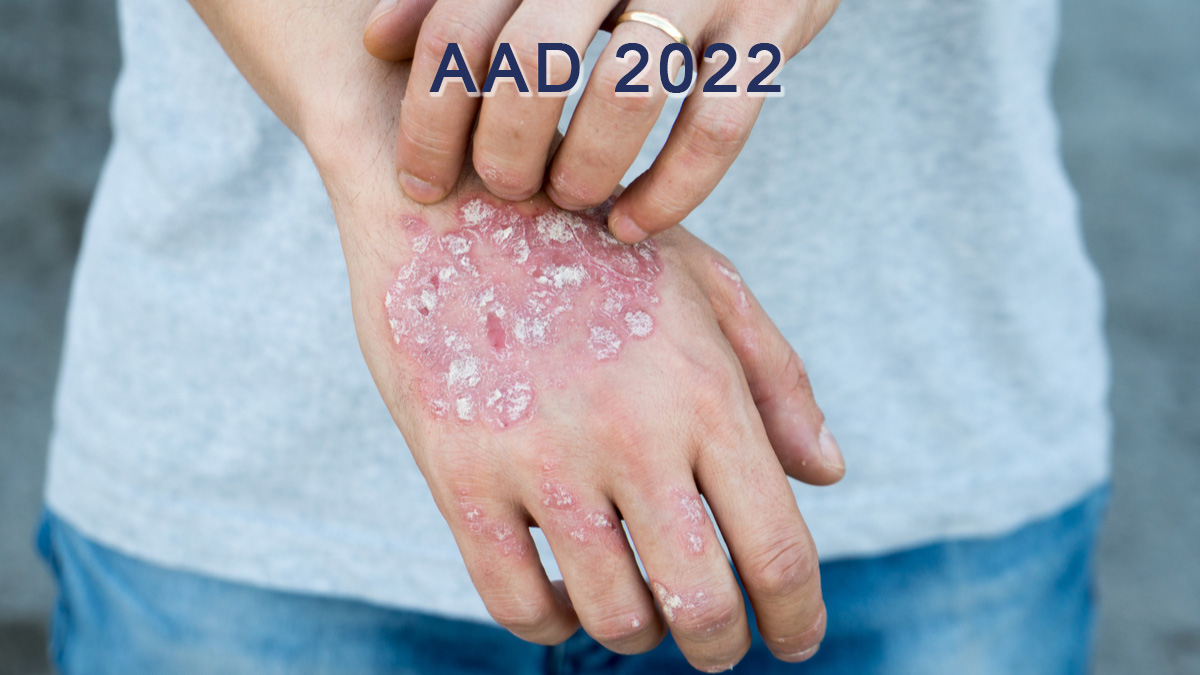 Logo der CME Fortbildung "AAD 2022: Update Psoriasis - Neues zur systemischen und topischen Therapie"