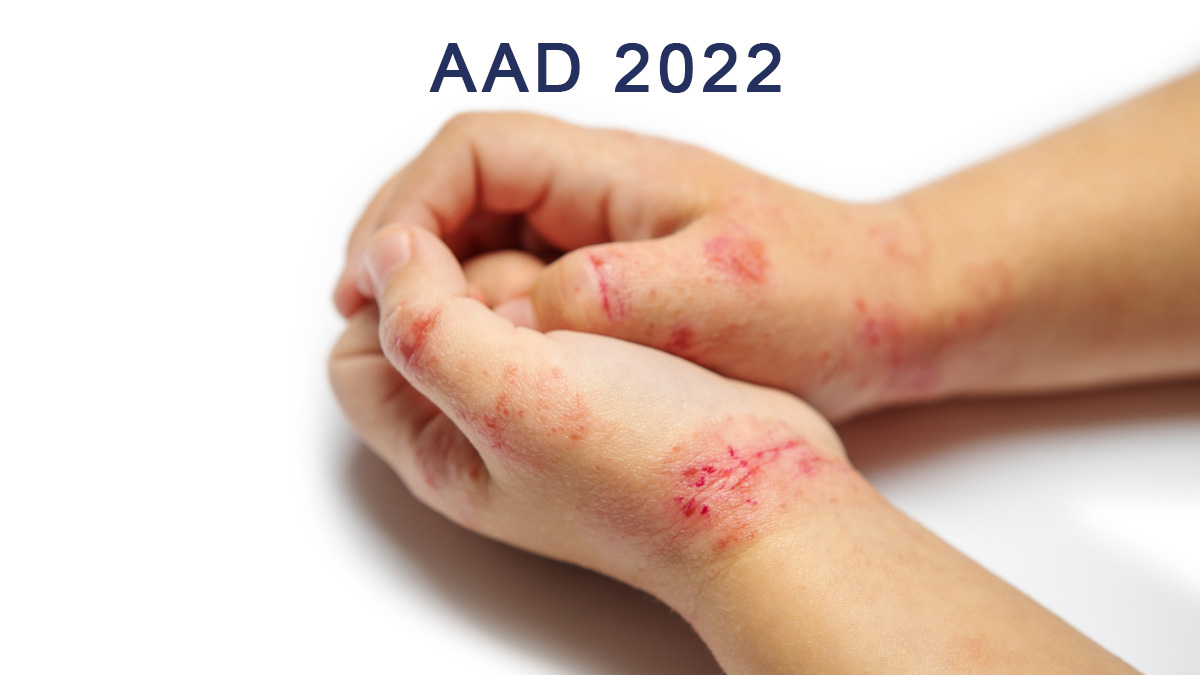 Teaserbild zum CME: AAD 2022: Update Atopische Dermatitis - Systemische und topische Therapie, Chronisches Handekzem, Nahrungsmittelallergie