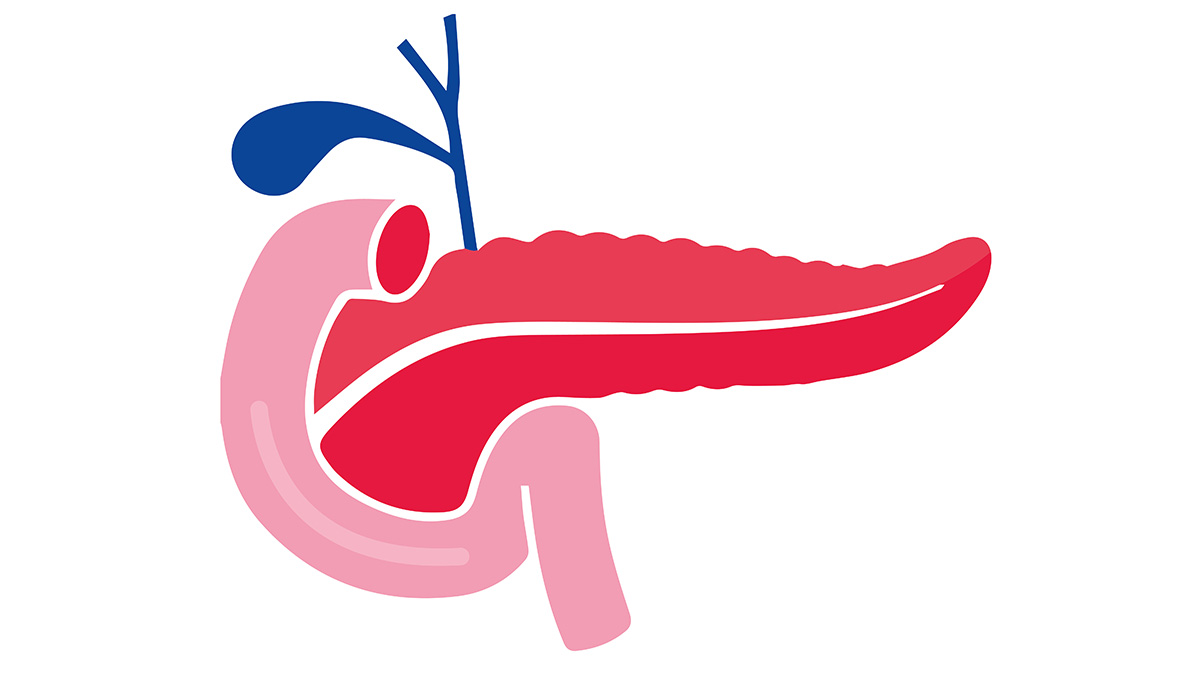Logo der CME Fortbildung "Komplikationen der chronischen Pankreatitis: Erfahrungen aus der Ambulanz - Neue DGVS-Leitlinie 2021"