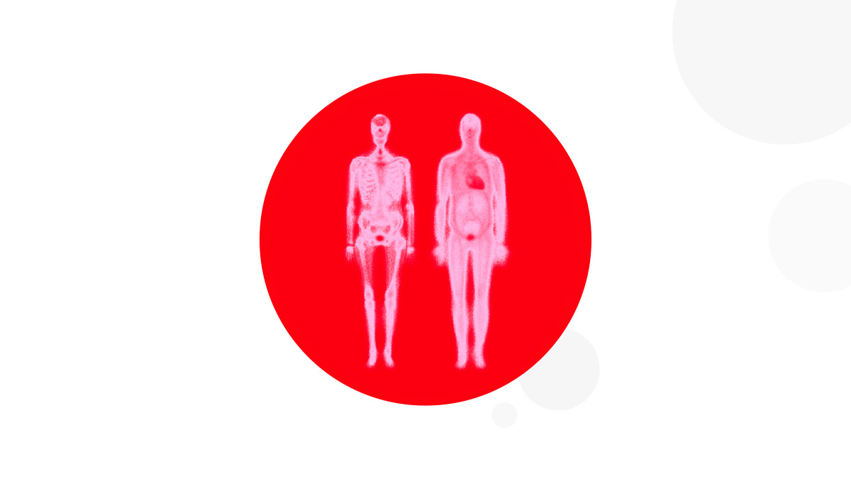 Logo der CME Fortbildung "Nuklearmedizinische Diagnostik bei kardialer Amyloidose"