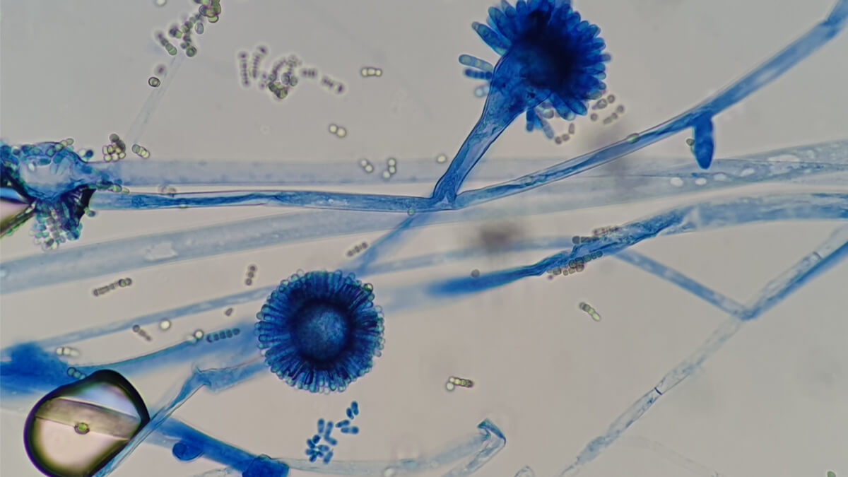 Teaserbild zum CME: Invasive Infektionen mit Aspergillus spp. und Pilzen der Ordnung Mucorales – Fokus Hämatologie