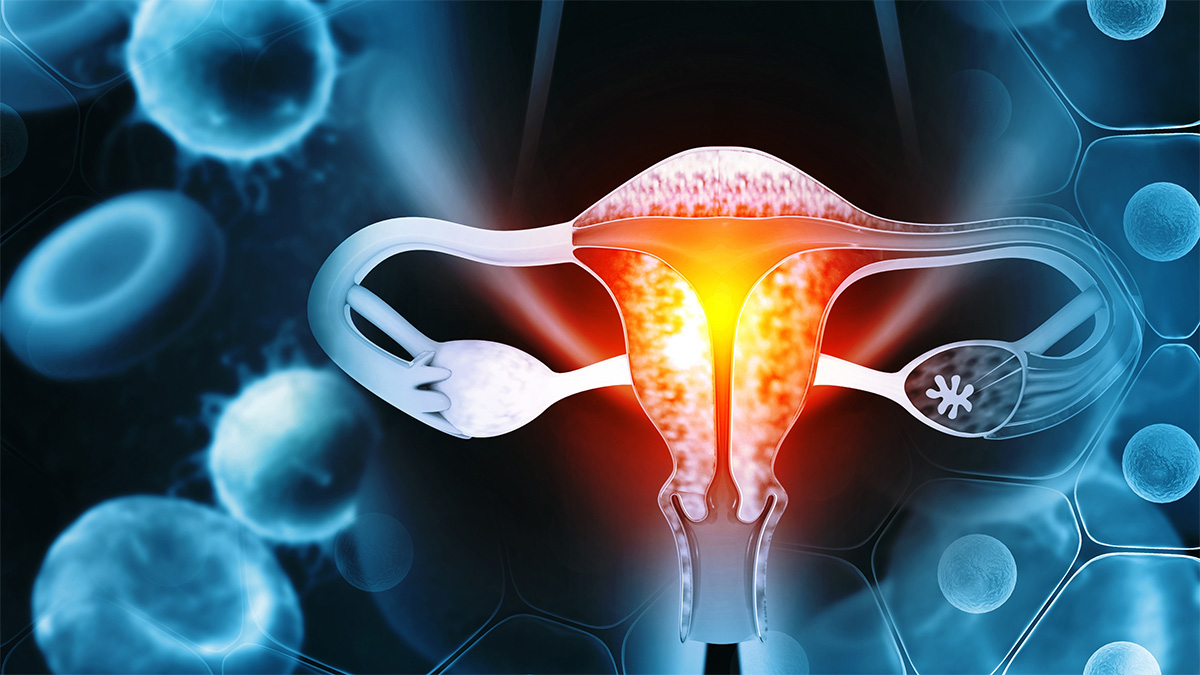 Logo der CME Fortbildung "Endometriumkarzinom - Update 2023: Was gibt es Neues für Klinik und Praxis?"