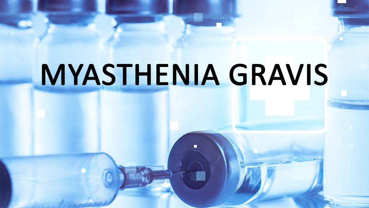 Teaserbild zum CME: Die neue Therapielandschaft in der Myasthenia gravis