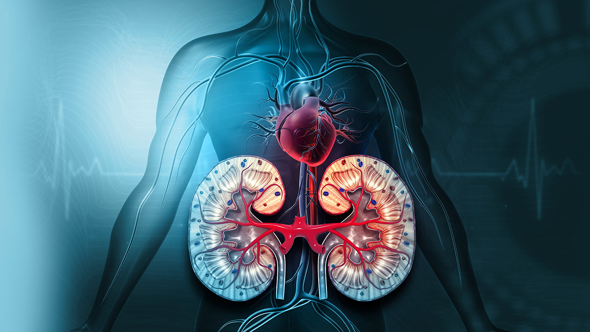 Teaserbild zum CME: Schnittstelle Nephrologie und Herzchirurgie: Die akute Nierenschädigung (AKI) im Fokus