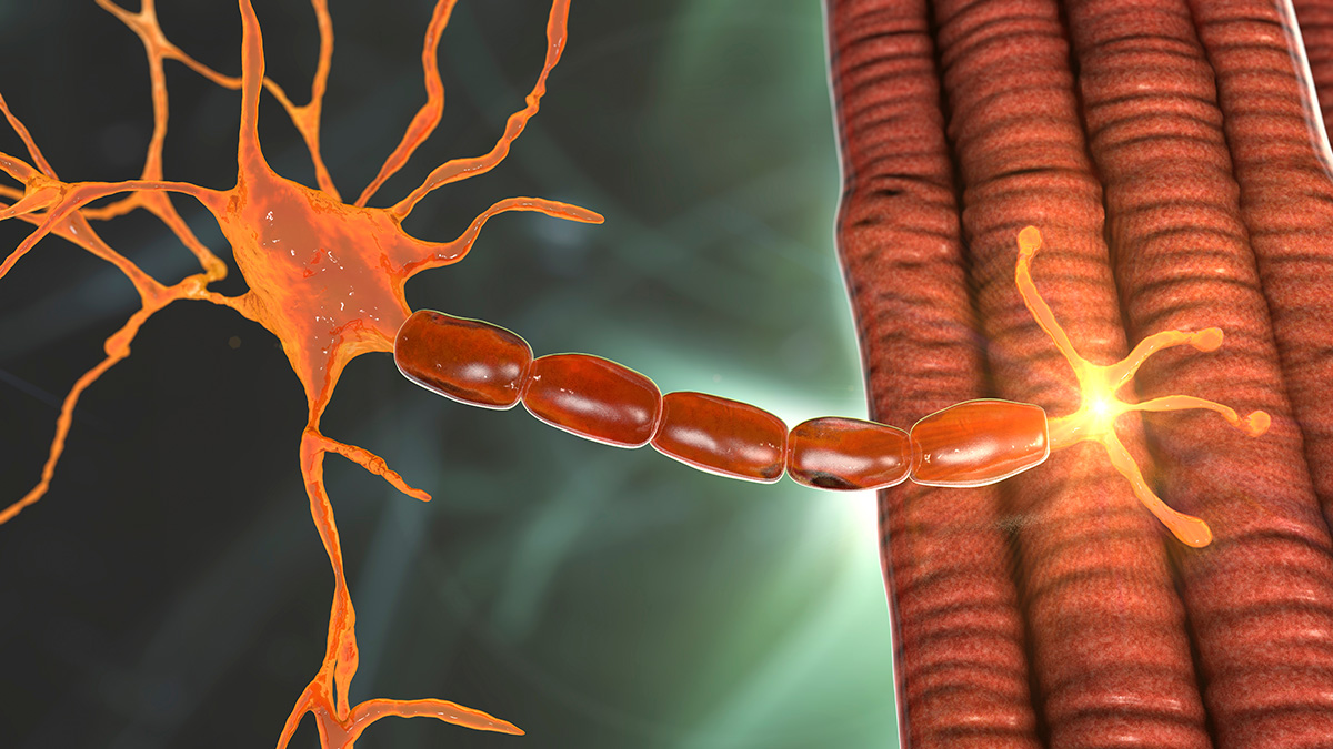 Logo der CME Fortbildung "Myasthenia gravis - ein Überblick"