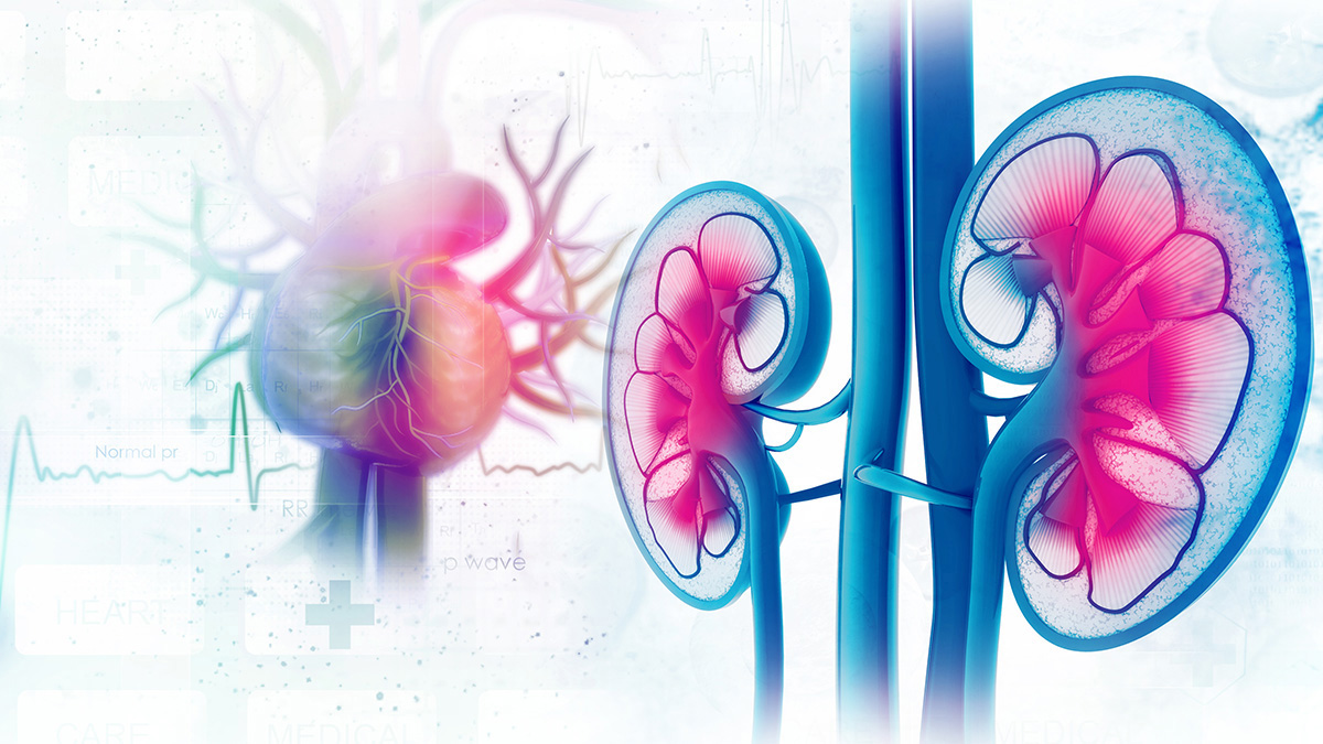 Teaserbild zum CME: Kardiorenales Syndrom