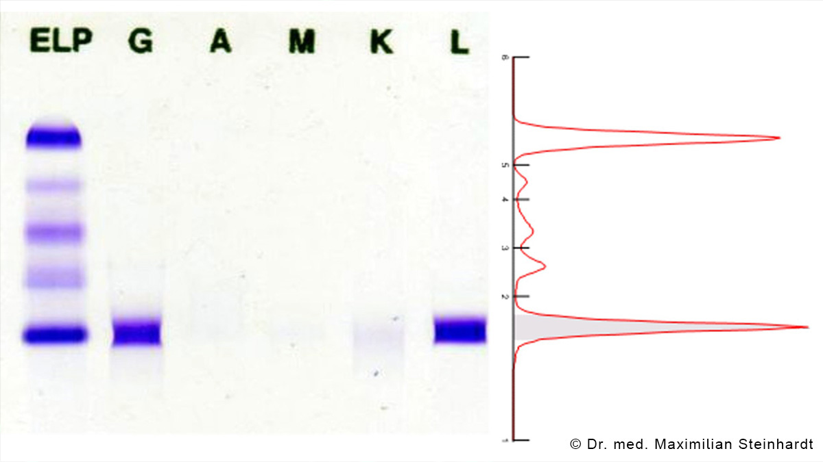 Logo der CME Fortbildung "Risiko-adaptierte Diagnostik bei monoklonalen Gammopathien – MGUS, Amyloidose, Myelom "