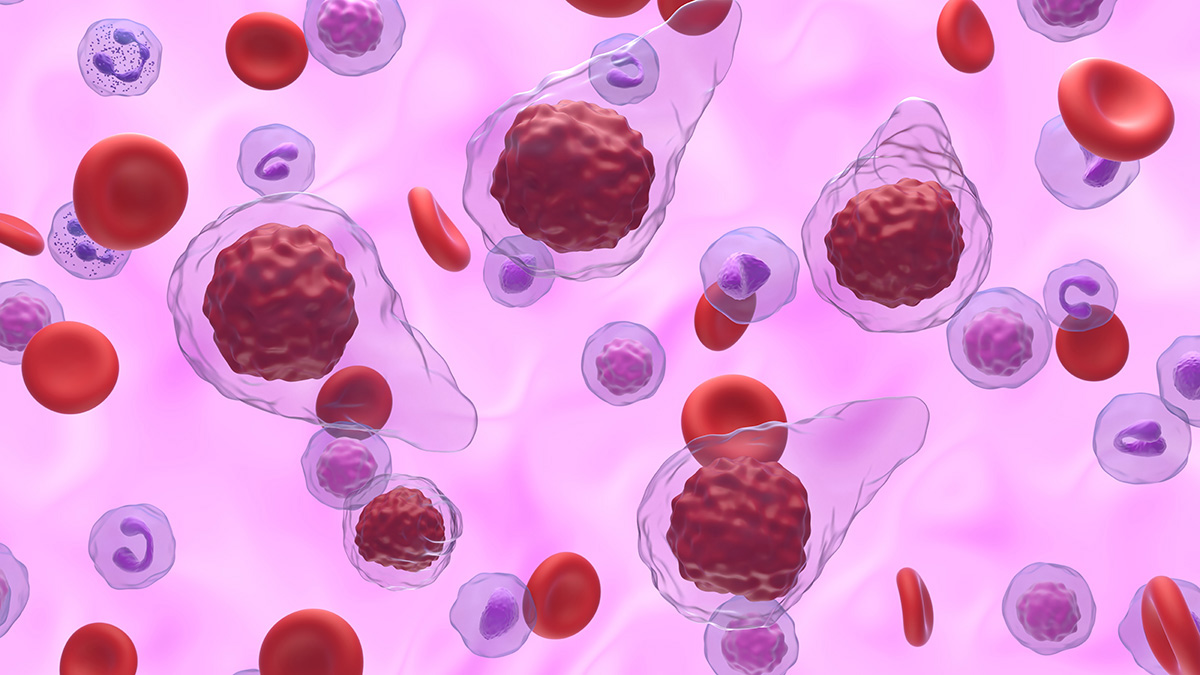 Logo der CME Fortbildung "Therapieziele in der Myelofibrose"