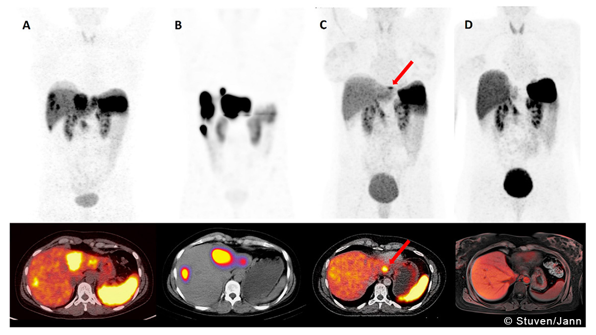 Logo der CME Fortbildung "Neuroendokrine Neoplasien: Aktuelle Therapieoptionen mit Fallbeispielen"