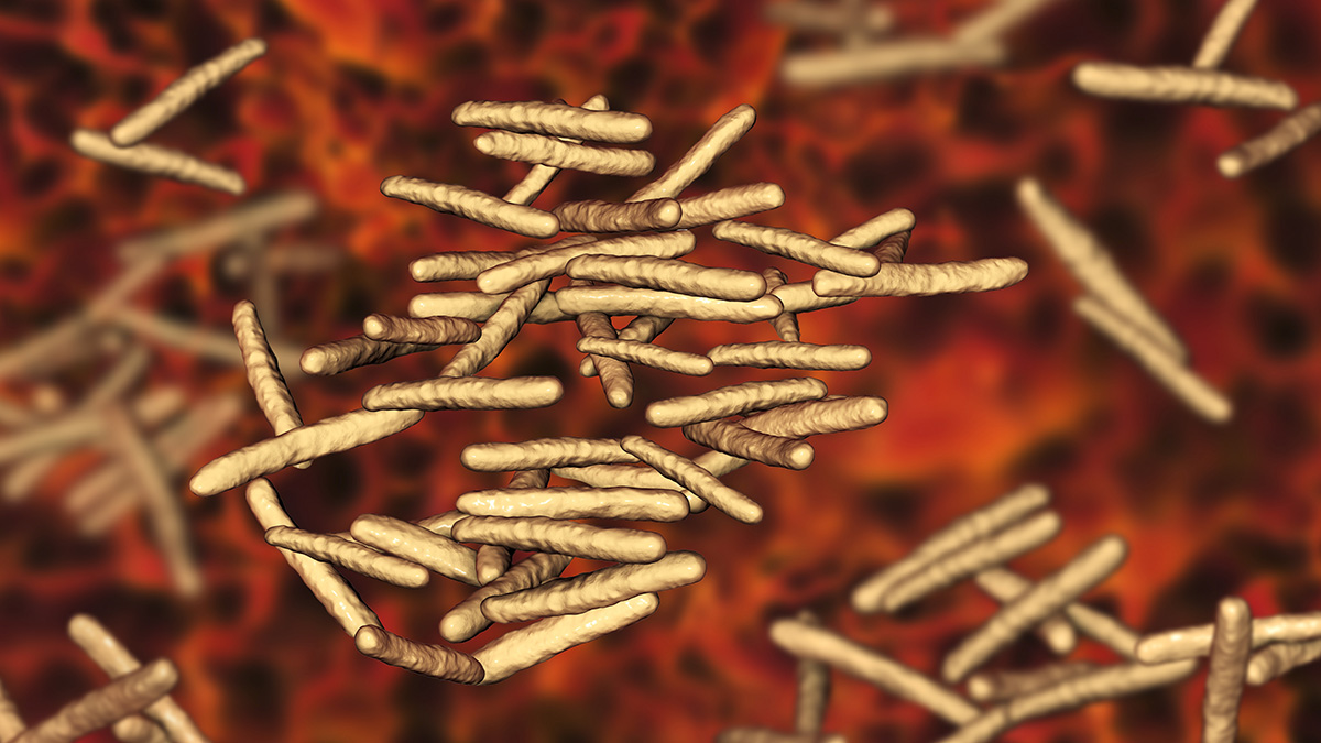Logo der CME Fortbildung "Nichttuberkulöse Mykobakterien (NTM): Lungenerkrankungen diagnostizieren und leitliniengerecht behandeln"