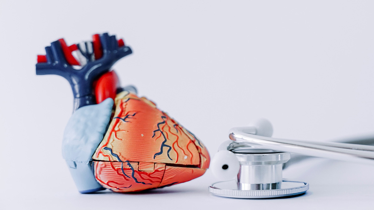 Teaserbild zum CME: Direkte orale Antikoagulation bei Erwachsenen mit nicht-valvulärem Vorhofflimmern (VHF) – Therapietreue und Umstellung professionell managen