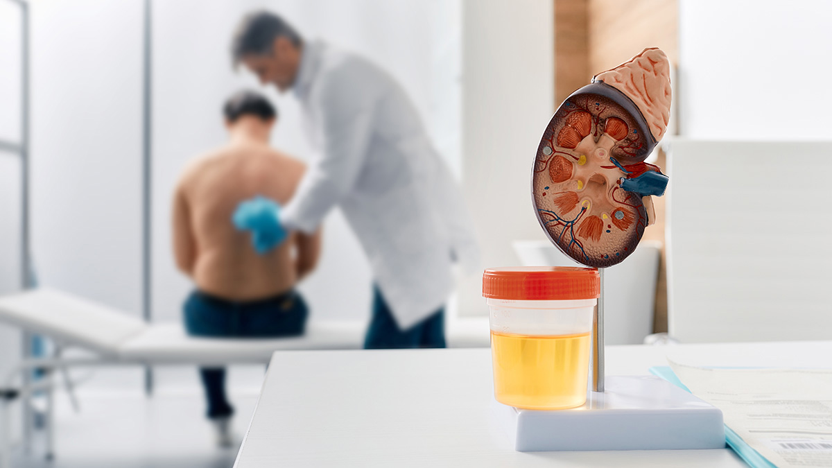 Teaserbild zum CME: Chronische Nierenkrankheit (CKD) - Erkennen und Behandeln im Praxisalltag Teaserbild zum CME: Chronische Nierenkrankheit (CKD) - Erkennen und Behandeln im Praxisalltag