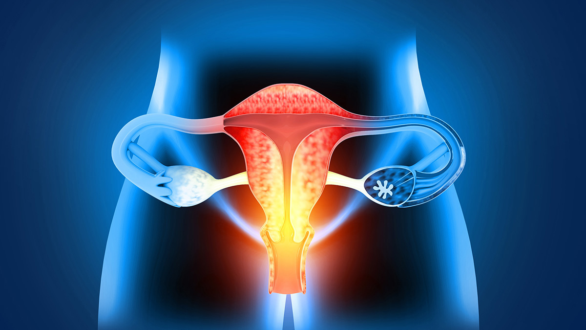 Logo der CME Fortbildung "Therapie beim lokal fortgeschrittenen Zervixkarzinom aus radioonkologischer Sicht "