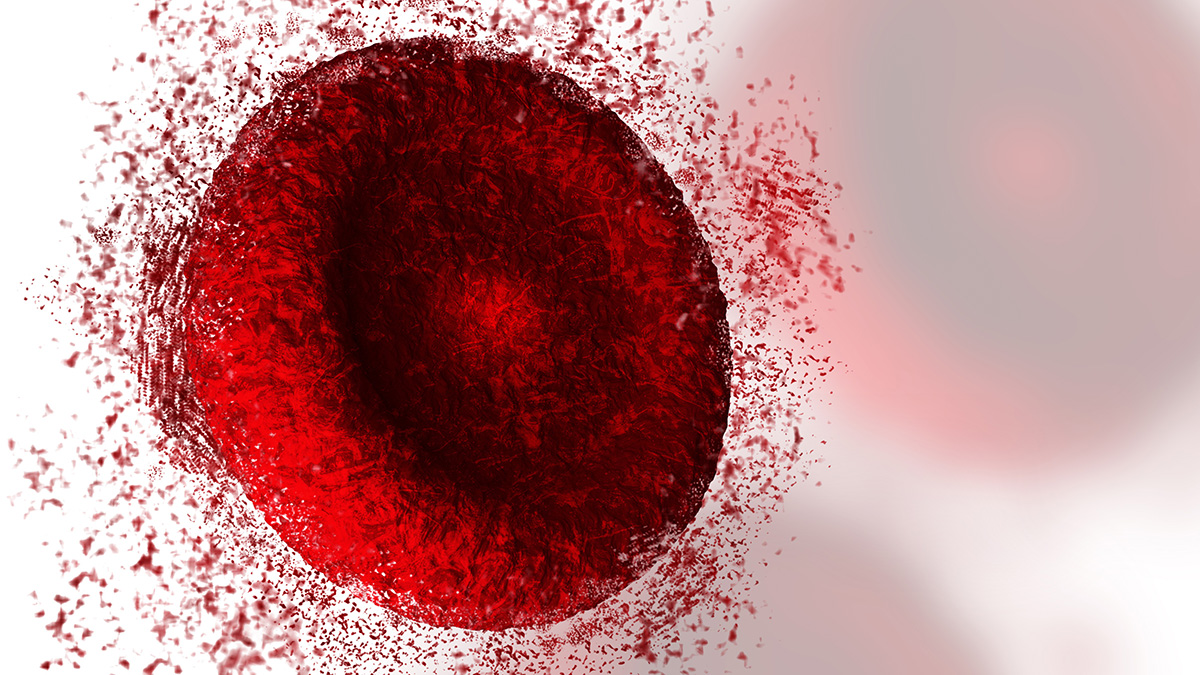 Logo der CME Fortbildung "Paroxysmale nächtliche Hämoglobinurie (PNH): Therapieziele und Verlaufskontrollen"