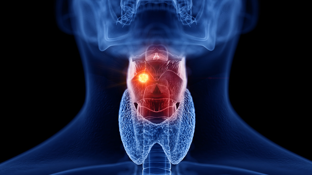 Logo der CME Fortbildung "Medikamentöse Therapiesequenz beim rekurrenten/metastasierten Plattenepithelkarzinom des Kopf-Halses (r/m HNSCC)"