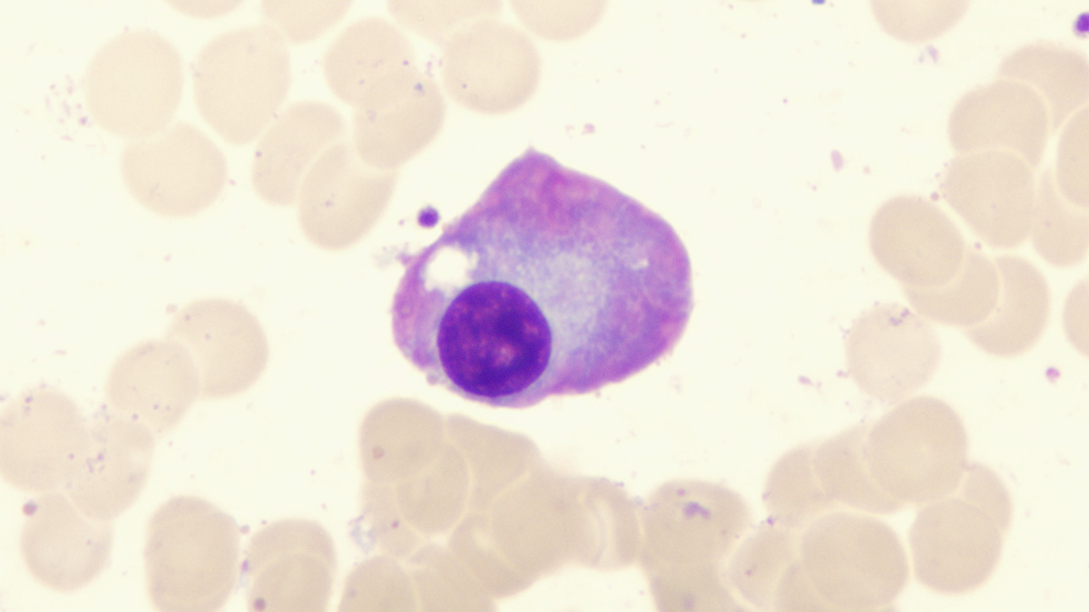 Logo der CME Fortbildung "Multiples Myelom: Die moderne RRMM-Therapie - aktuelle Daten und Einordnung"