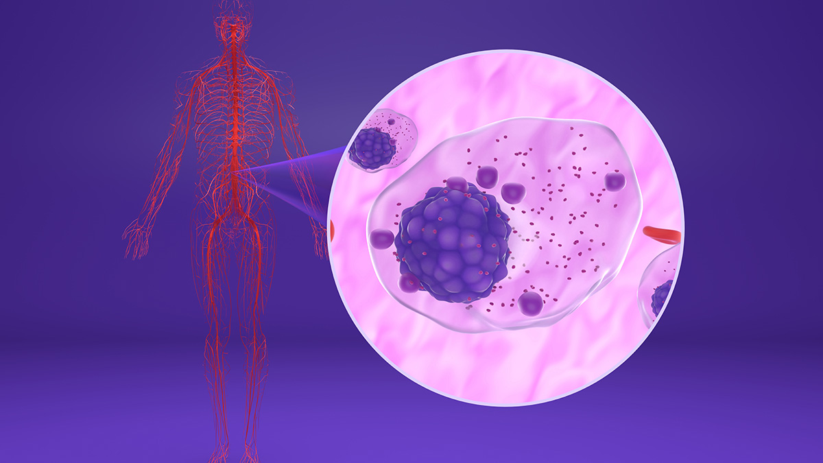 Logo der CME Fortbildung "Multiples Myelom - Praktische Anwendung der modernen Immuntherapien beim RRMM"