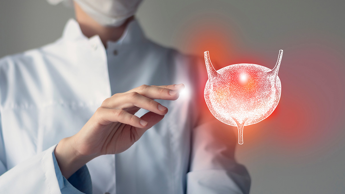 Logo der CME Fortbildung "Urothelkarzinom: Leitliniengerechte Therapie und Praxis"