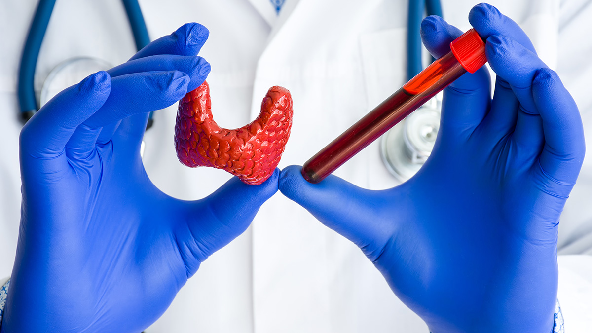 Teaserbild zum CME: Erhöhter TSH-Wert und Schilddrüsenerkrankungen in der Hausarztpraxis - Aktuelle Leitlinie 2023