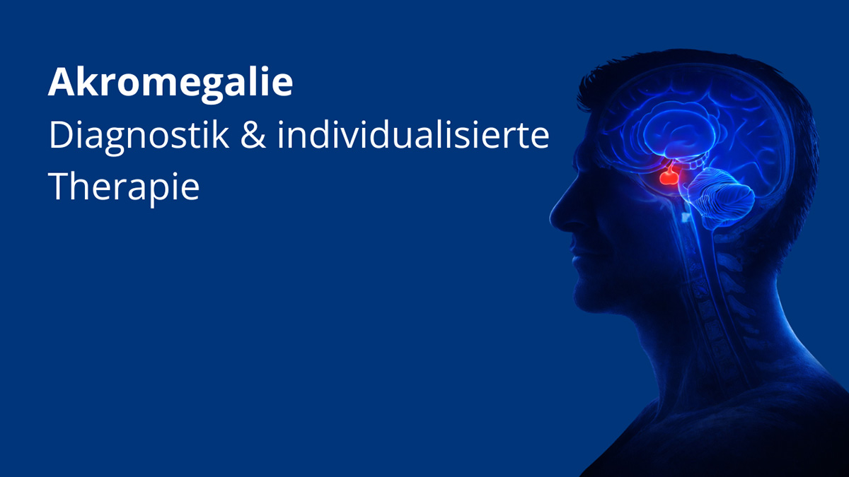 Logo der CME Fortbildung "Akromegalie"