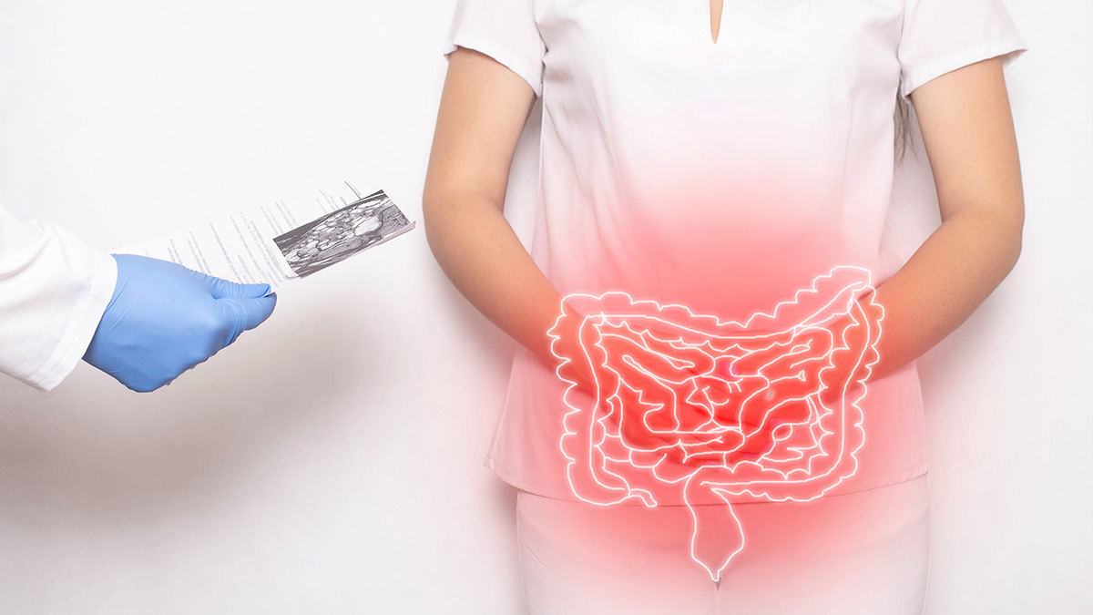 Logo der CME Fortbildung "Highlights vom ECCO 2026 zu CED - Kombinationstherapien, Ileozökalresektion & Top-down-Behandlung"